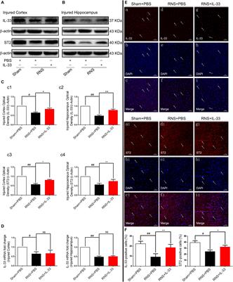 IL-33 Alleviated Brain Damage via Anti-apoptosis, Endoplasmic Reticulum Stress, and Inflammation After Epilepsy